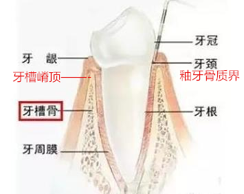 吕长胜 整牙的并发症和预防（附照）1.jpg