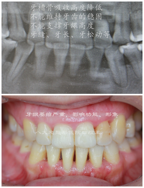 吕长胜 整牙的并发症和预防（附照）2.jpg